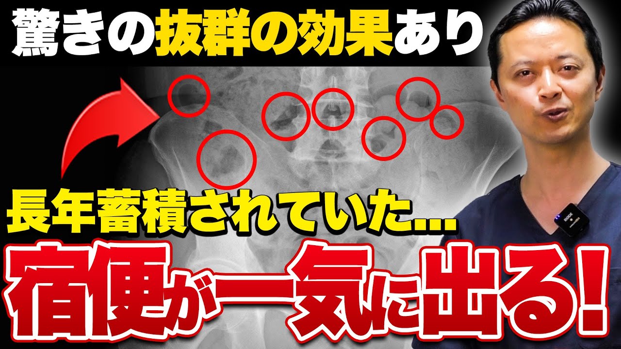 1766558007_maxresdefault-5665787-3191830-jpg